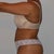 35 Days Post Op Side View (6/23)