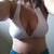 I week post Op
