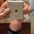4 month po scar area----I think the area between the bb and scar has some residual swelling.  I think I have seen it flatter.