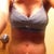 2 weeks post op