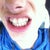 Aligner # 4 ( Is it me or do my teeth get whiter with every new aligner.)