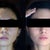 Before mild acne but really oily face. After, clean, matte but radiant face, smaller nose (maybe due to less inflammation of the skin)