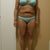 Pre Op in my blue bikini....this is exactly why I never wore a bikini.