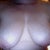 Before surgery! 36 FF (5D's)