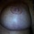 Left Breast 4 wk