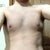 Pre-op torso