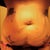 After up and down weight and two pregnancies, my skin just didn't bounce back. Just under 5 pounds of excess skin and flesh were removed.