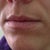 Lips Before