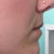 Lips Before (so flat on my upper lip. i really want some definition!)