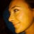 2.5 weeks after surgery
(the tip is still swollen)