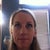 2 weeks post op - swelling subsiding and looking better each day!