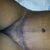 excuse the close up of my little woman here but look at the incison... 1 day post op