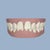 Pre- invisalign