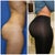 Not really a fan of a really high "shelf," wonder if Dr. S could achieve like this with me. (dont think these are pics of the same person, i just placed them side by side because i really like that look.)