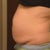 Before - Ugh!