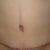8 weeks post-op.
