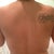 3 day post op back
