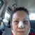 Day 1 after surgery