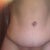 18 days after revision