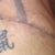 18 days after revision. A bit swollen still.