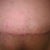 18 days after
