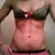 (before) here you can see my diastasis recti