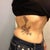 1 year - I'll have to take one of the scar but it's much lighter/faded/