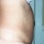 Before-side
