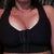 a couple hours post op..feeling like crap ;[ but LOVE how i dont have to wear a padded bra anymore! LOL :)