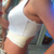 Post-Op 1 week