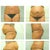 12 Weeks PO, before and after pics