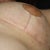 Scars healing well, thanks I am sure to paper-taping