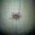PO Revision BB. I am not sure if she redid my BB or not. Looks like she did some lipo all around here. Will ask her what was done to by BB tomorrow.