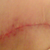 up close of the scar. I think its looking pretty good.