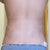 1 week after