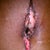 My belly button was I went to the ER! grossssss!