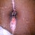 My belly button now! Slow healing process!