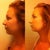B4 - after