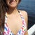 Before picture of this summer before my procedure.