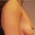 2 weeks after op