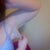 Loose skin under the armpit, and its the same elasticity on my breast as well.
