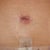 2 weeks-Belly button up close