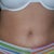 6wks post