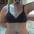 Front view 6 weeks post