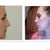 Morph vs Actual