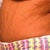 swollen!!!!! but getting flatter everyday