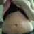 1 Month