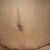 Day 21 post-op.