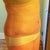 4 wks post-op.  Still a lot of swelling.