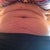 Loose skin. Courtesy of my boys.  Love them!